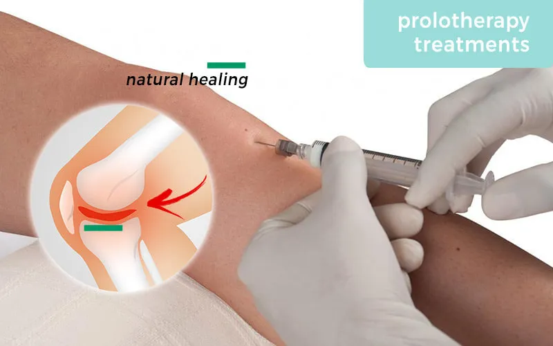 Prolotherapy - naturopathic care at Anchor Integrative Health, Calgary
